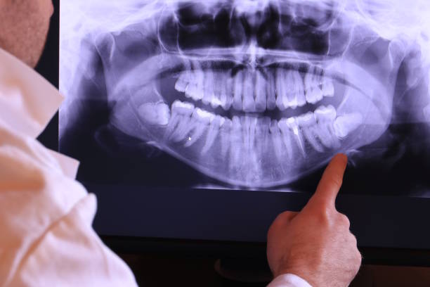 Best Pediatric Emergency Dentist in Rainbow, CA
